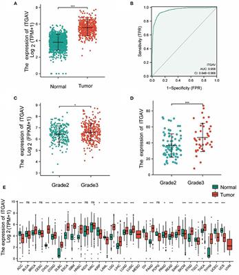 Integrin subunit alpha V is a potent prognostic biomarker associated with immune infiltration in lower-grade glioma